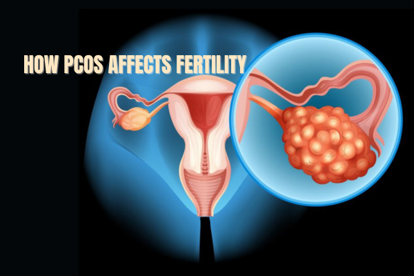 Fetal Medicine